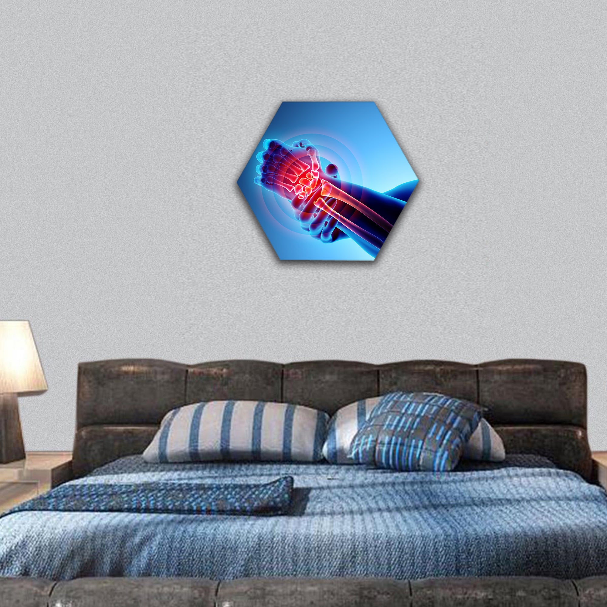 Wrist painful, skeleton x-ray hexagonal canvas wall art