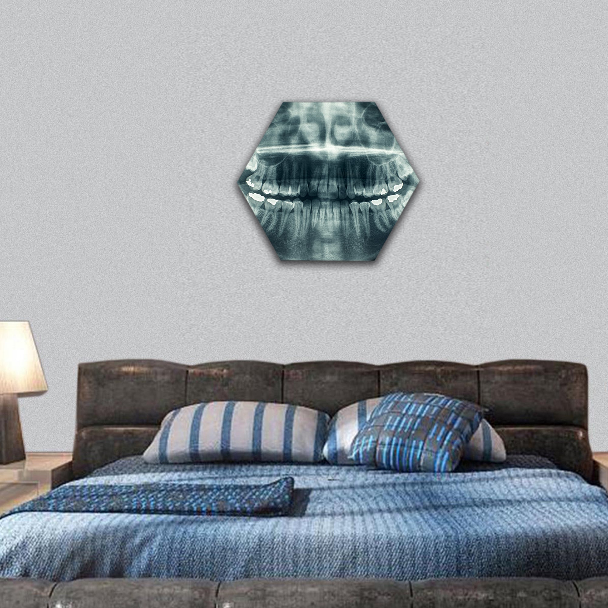 Dental x-rays hexagonal canvas wall art