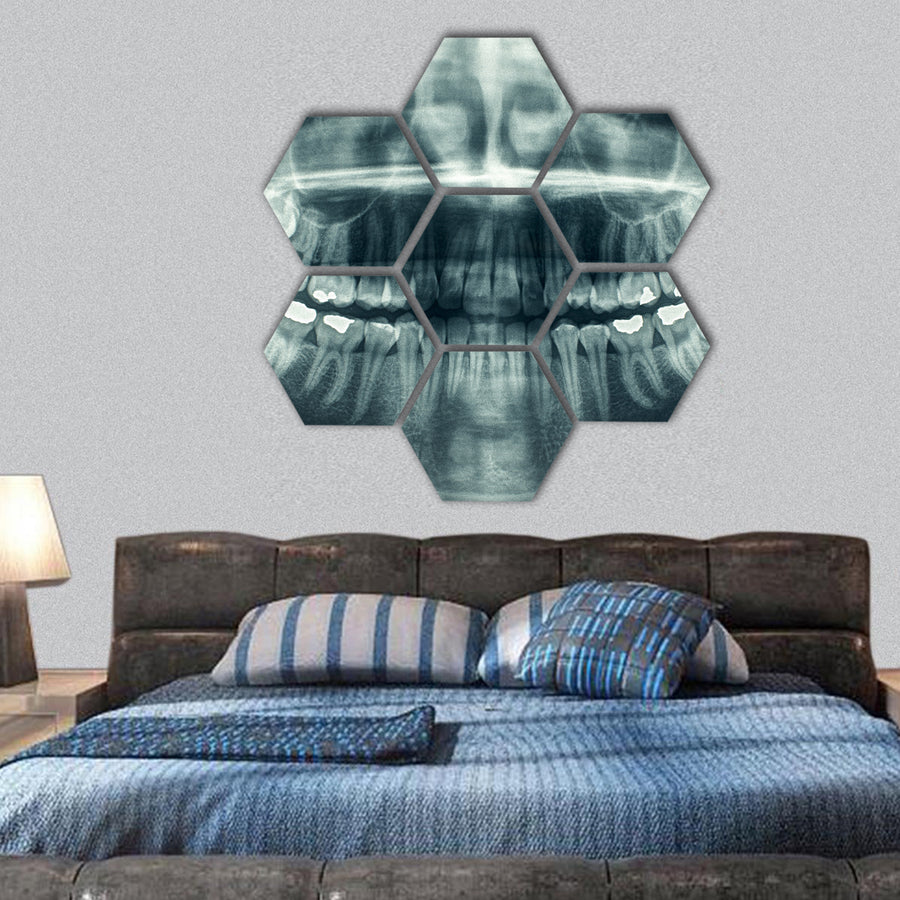 Dental x-rays hexagonal canvas wall art