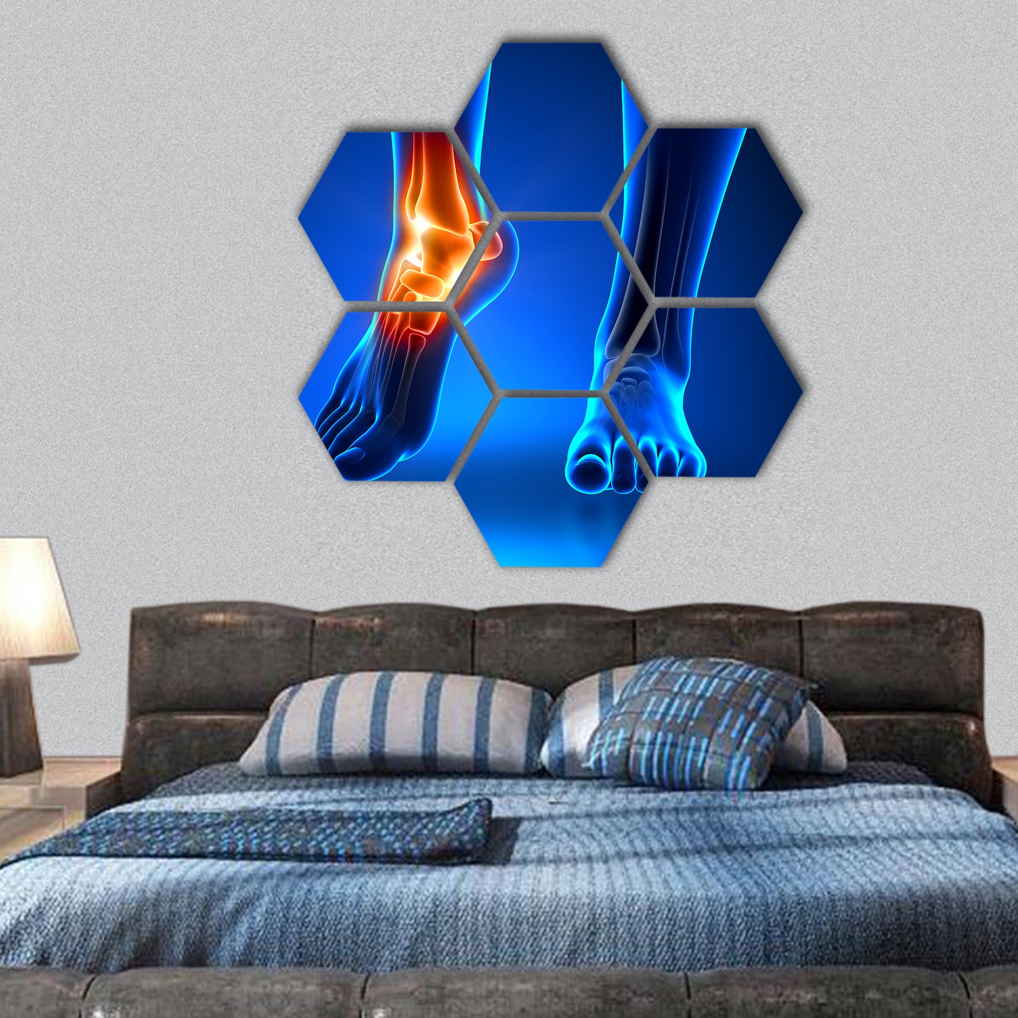 Ankle pain hexagonal canvas wall art