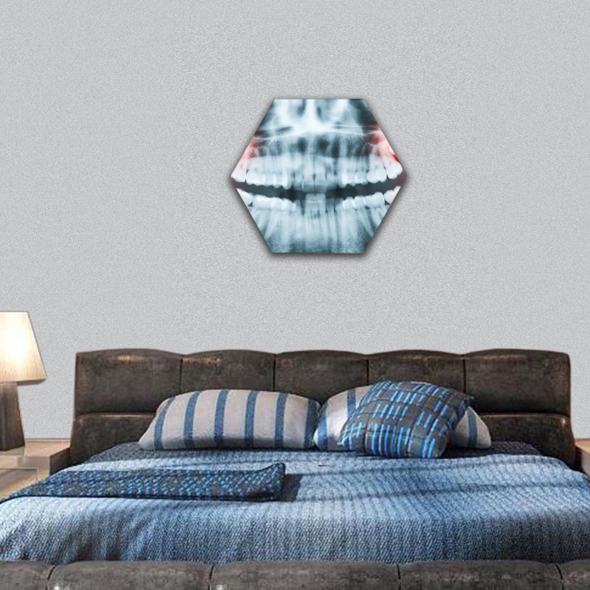 x-ray image of teeth and mouth with all four molars hexagonal canvas wall art
