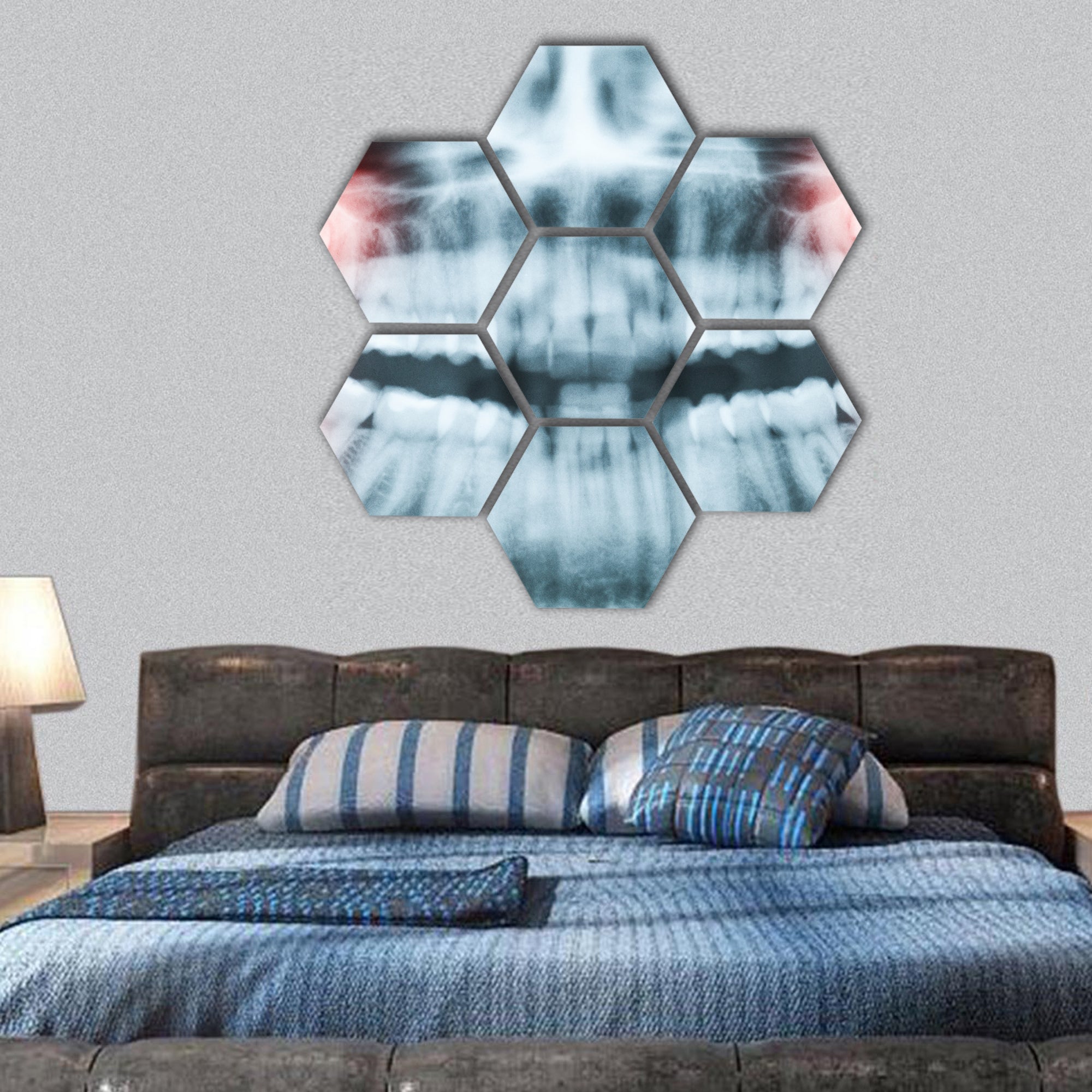 x-ray image of teeth and mouth with all four molars hexagonal canvas wall art
