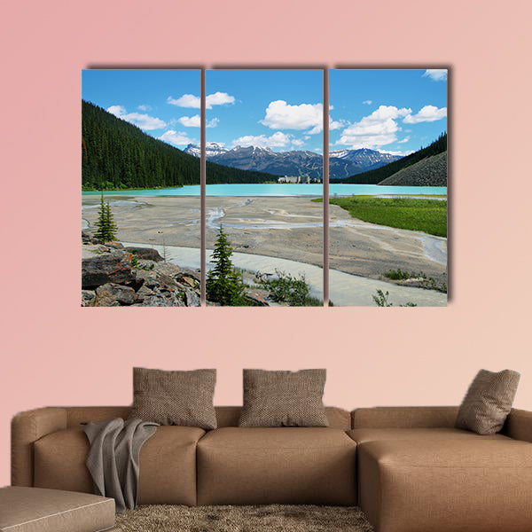 Lake Louise mountain lake with Chateau Lake Louise at background, wall art