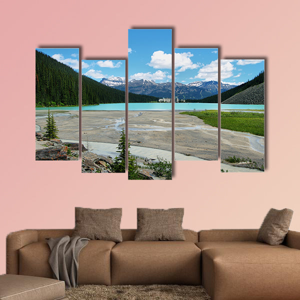 Lake Louise mountain lake with Chateau Lake Louise at background, wall art