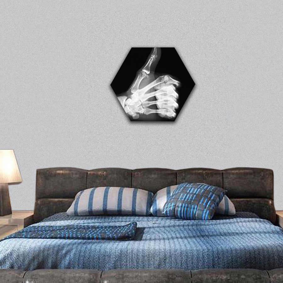 X-ray of thumb hexagonal canvas wall art