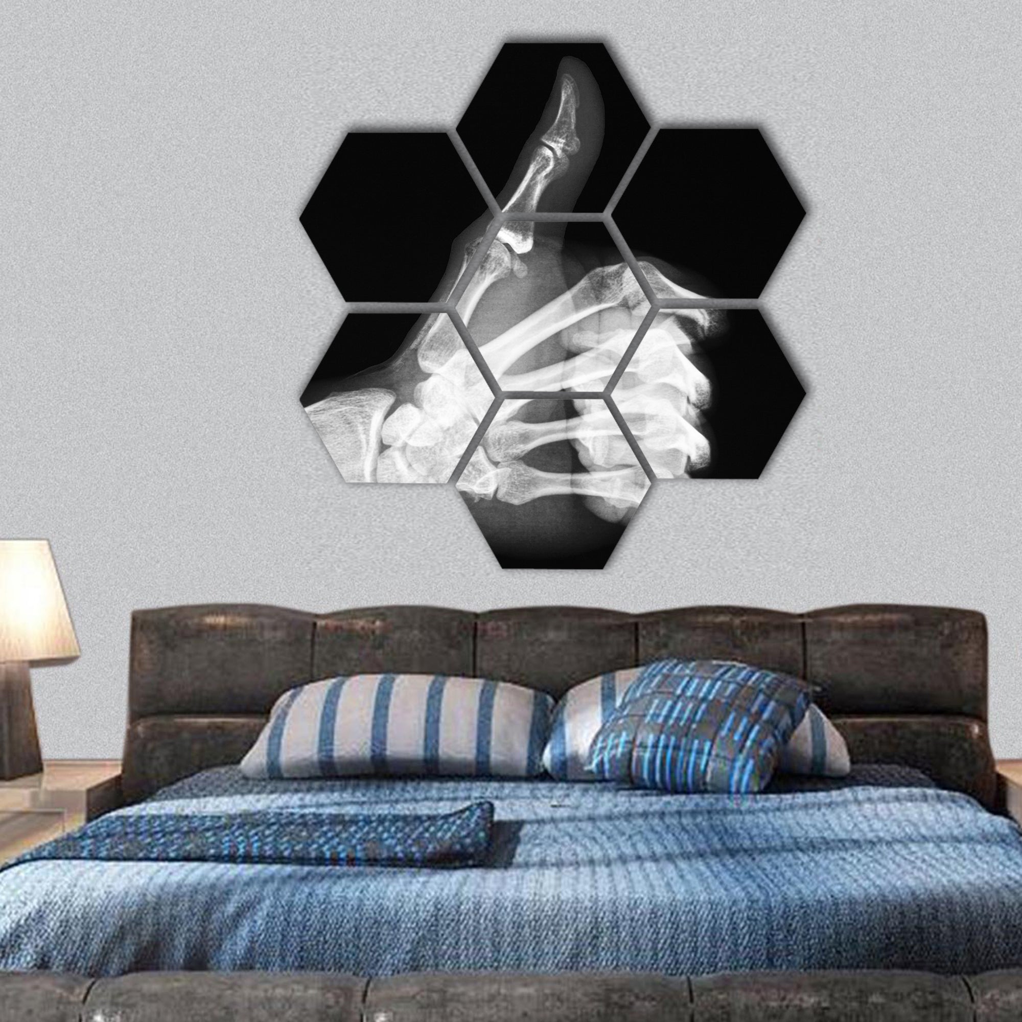 X-ray of thumb hexagonal canvas wall art